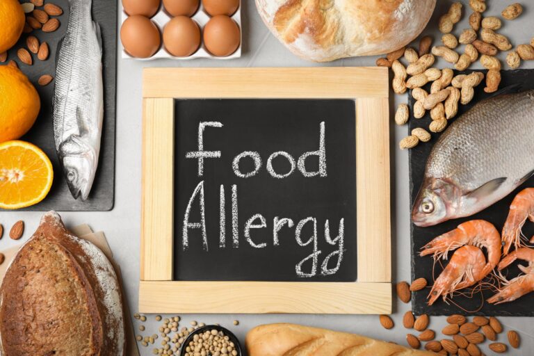 Allergen-Kennzeichnung 2026: EU-LMIV für Restaurants